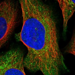 Serine Dehydratase Antibody, Novus Biologicals:Antibodies:Primary Antibodies